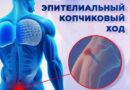 Эпителиальный копчиковый ход